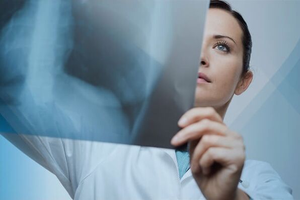 X-ray is a popular method for diagnosing cervical osteochondrosis.